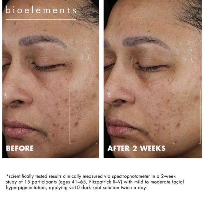 Bioelements vc10 Dark Spot Solution 15ml