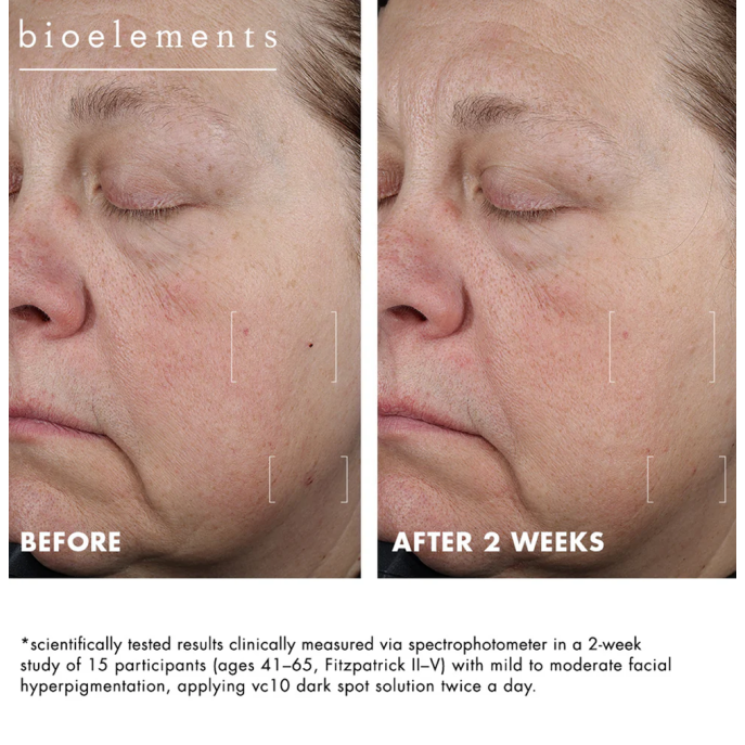 Bioelements vc10 Dark Spot Solution 15ml