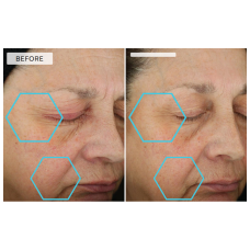 Dermaquest Peptide 3D Eye Lift 15ml