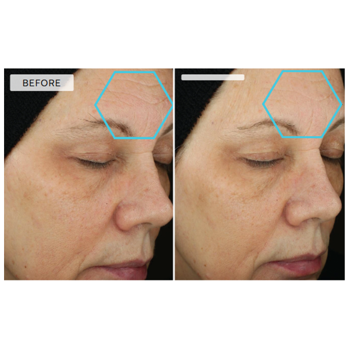 Dermaquest Peptide 3D Eye Lift 15ml