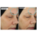 Dermaquest Peptide 3D Eye Lift 15ml
