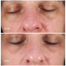 HydroPeptide Collagen Reactivate PM 30ml