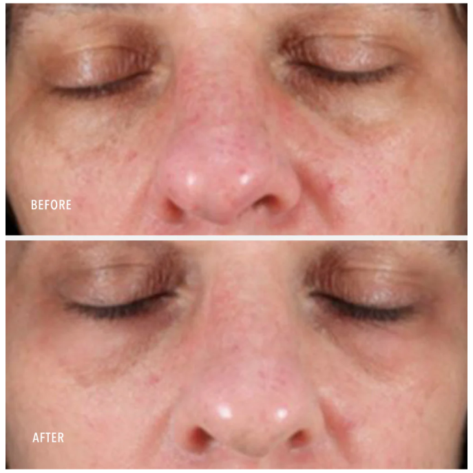 HydroPeptide Collagen Reactivate PM 30ml