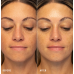 HydroPeptide HydroLuxe Oxygen Facial