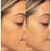 HydroPeptide HydroLuxe Oxygen Facial