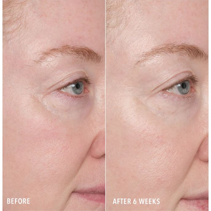 HydroPeptide Resurface & Repair Peptide Pads 30 tk