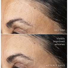 Medik8 C-Tetra Advanced 30ml