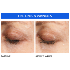 PCA Skin Hyaluronic Acid Microneedle Eye Patches 1x50mg