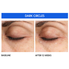 PCA Skin Hyaluronic Acid Microneedle Eye Patches 1x50mg