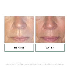 Replenix Glycolic Acid 20% Resurfacing Cream 50ml