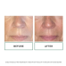 Replenix Glycolic Acid 20% Resurfacing Cream 50ml