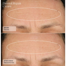 Senté Dermal Repair Cream 30ml