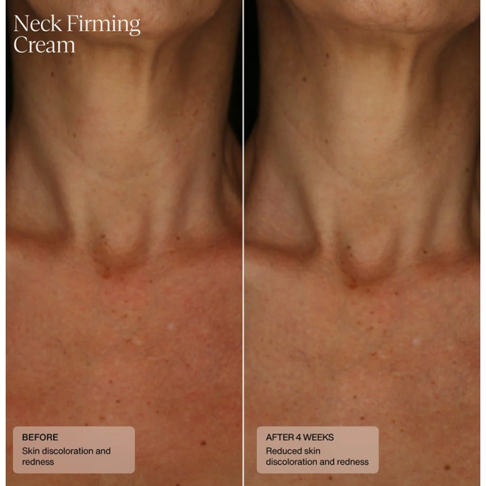 Senté Neck Firming Cream 50 ml