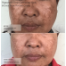 Senté Pigment & Tone Correcting Mask 50ml