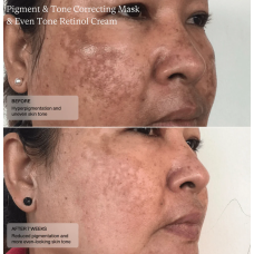 Senté Pigment & Tone Correcting Mask 50ml