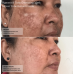 Senté Pigment & Tone Correcting Mask 50ml