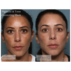 Senté Pigment & Tone Correcting Mask 50ml