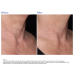 ZO Skin Health Neck Complex Anti-aging + Brightening Serum 50ml