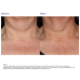 ZO Skin Health Neck Complex Anti-aging + Brightening Serum 50ml