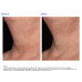 ZO Skin Health Neck Complex Anti-aging + Brightening Serum 50ml